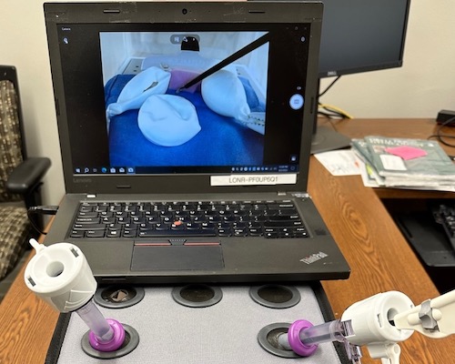 Ideal Ovarian Cystectomy Sim