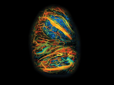 Visualization of a mouse's placenta