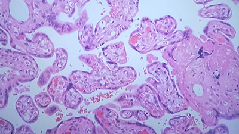 Slide from Frozens Lab