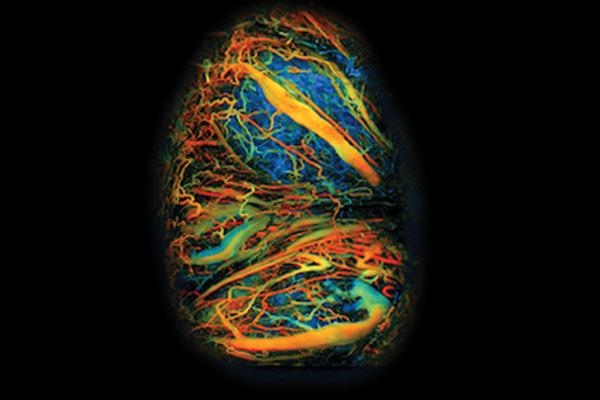 Image of placental develpment in mice